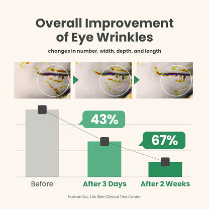 🔥Summer Sale 30% OFF🔥Collagen Eye Serum